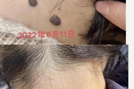 风水上女生脖子后面有痣代表什么啊