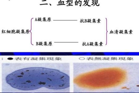 抗a凝集是什么血型