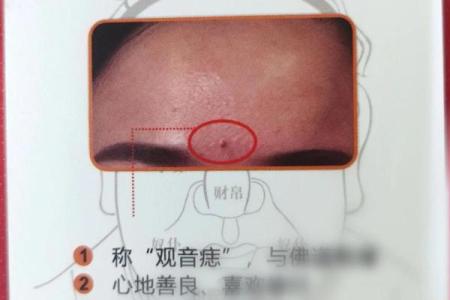 印堂痣和观音痣的区别,观音痣是大富大贵的代表