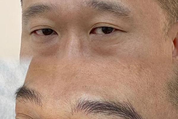 男人八字眉能嫁吗?八字眉男人命运怎么样? 男人八字眉能嫁吗?八字眉男人命运怎么样?
