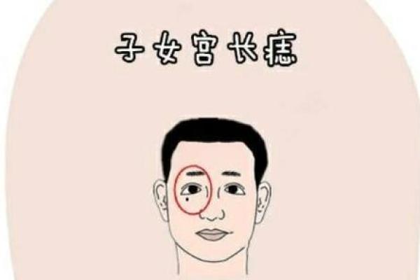 痣长在脸上哪个位置好 有福气之人财神眷顾