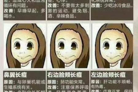 长痘风水学