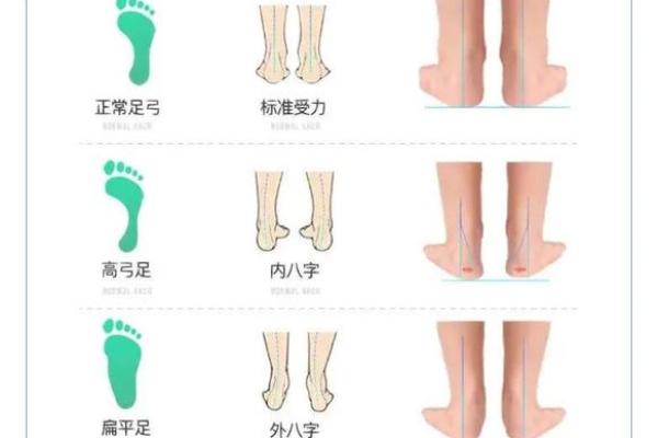 八字型腿