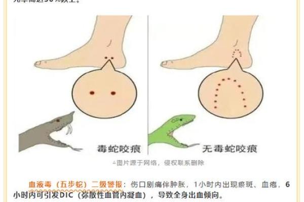 风水梦见被蛇咬是什么意思好不好